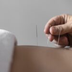 jarum akupuntur pada pinggang manusia